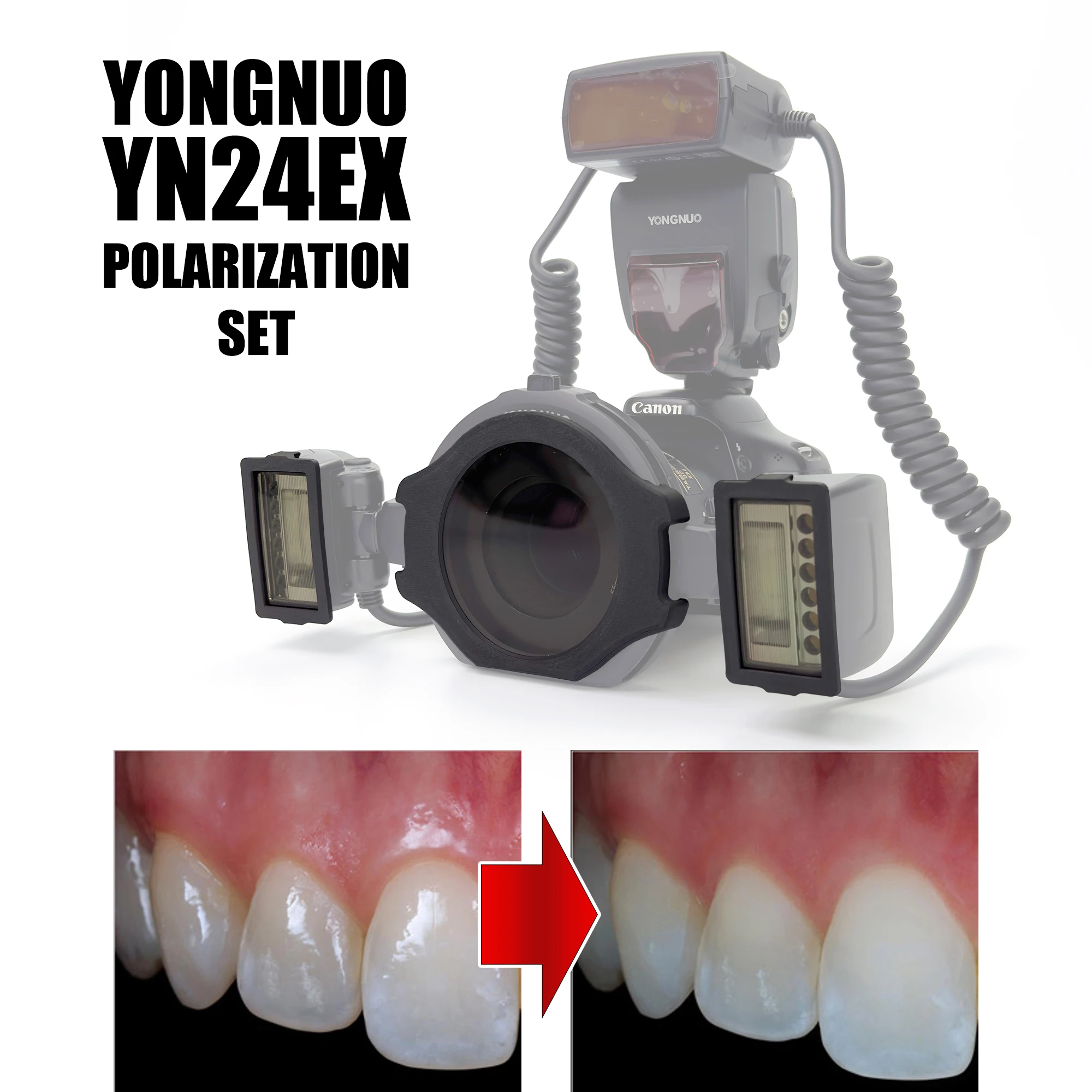 Polar Eye - YONGNUO YN24 Flash Cross Polarization Set For Dental Photography - No Reflections, No Glare Photo Kit For Dentistry