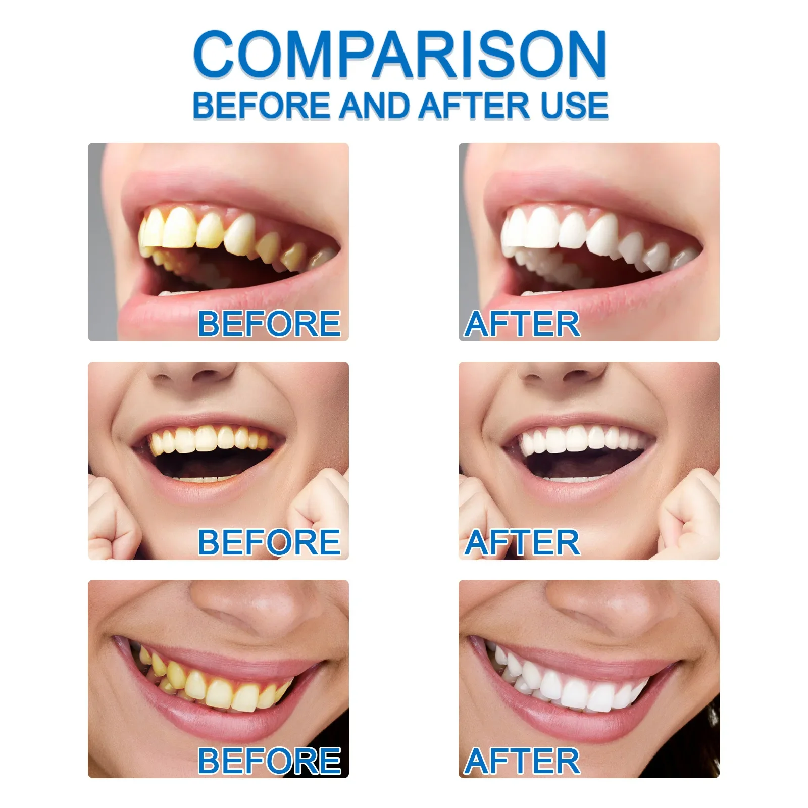 Elimina manchas de placa, suero contra caries dentales, construcción de dientes fuertes, blanquea el aliento fresco, herramientas de limpieza de higiene bucal