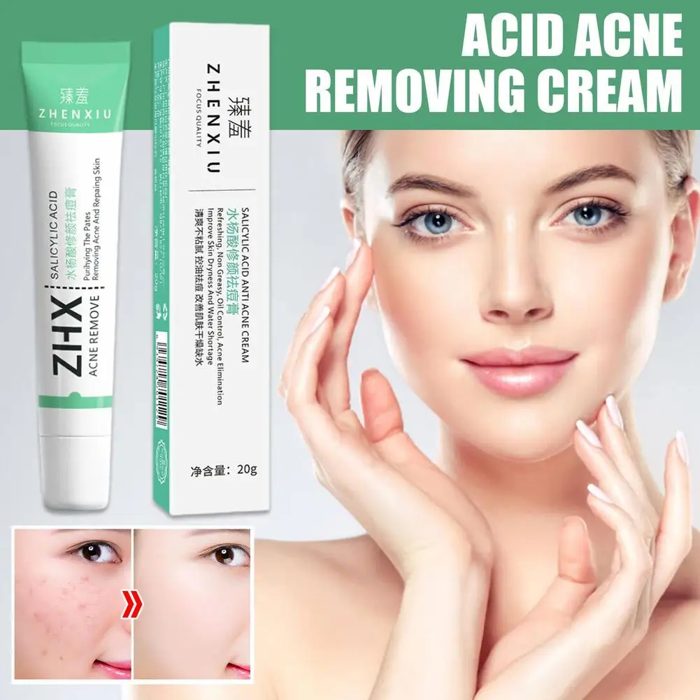 Effective Salicylic Acid Acne Removal Cream Blackhead Scar Spot Skin Whitening Pores Care Oil Fade Control Acne Shrink L5F5