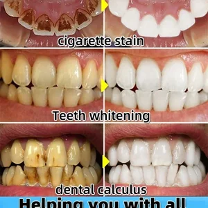 بخاخ معجون أسنان لتبييض الأسنان ، إزالة القلح ، التنظيف ، نظافة الفم ، إزالة رائحة الفم ، بقع البلاك ، العناية بالتنفس المنعش أعلى 8 مبيعات لمبخر الأعشاب - No8