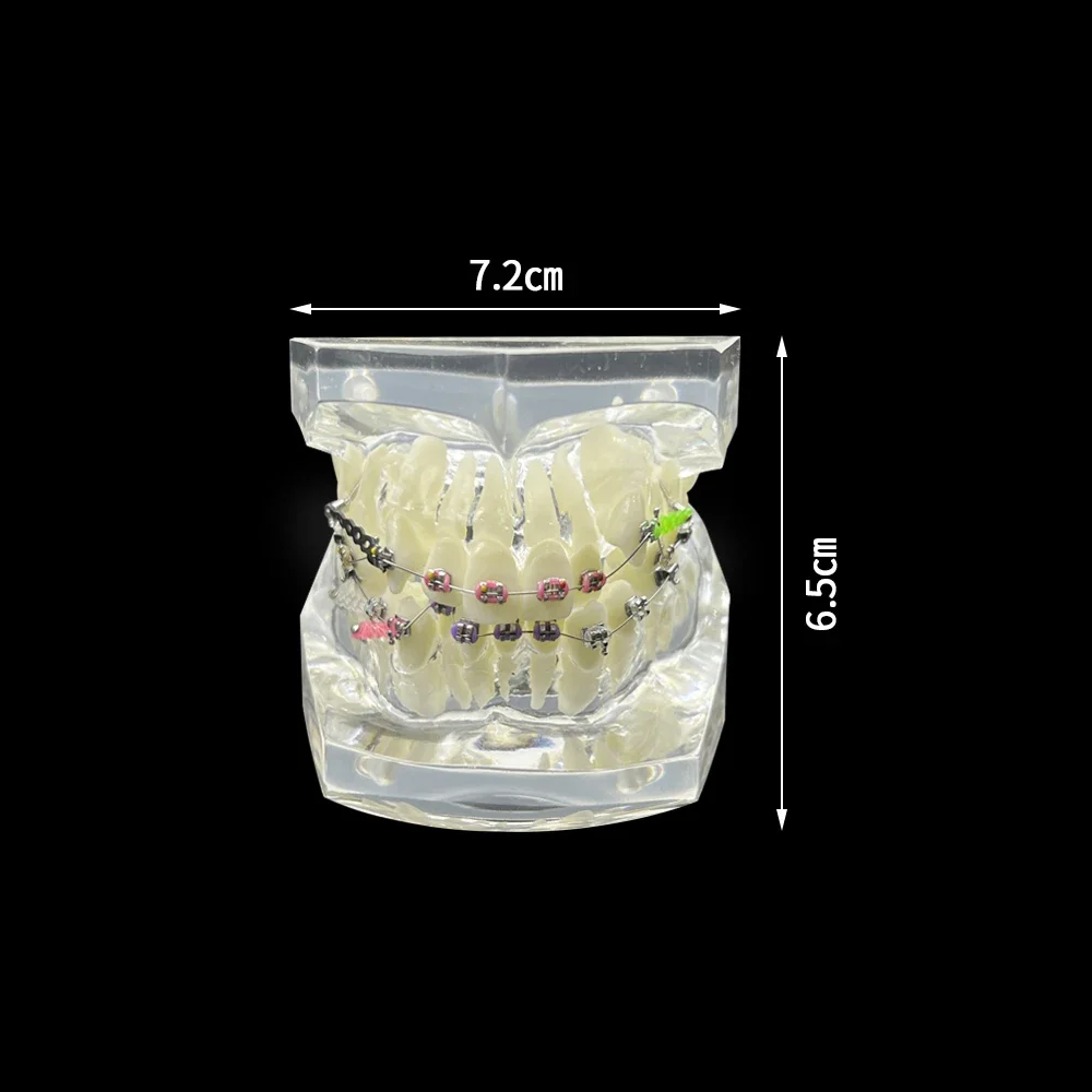 Typodont Malocclusion Orthodontic Model Study With Archwire Ligature Ties Brackets For Dentist Student Teaching Studing Demo