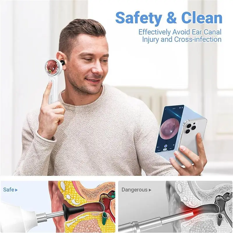 FEDI-Ear Camera With 1.85In IPS Screen, 720P HD Digital Otoscope, Ear Wax Removal Tool, Otoscope With Light, Video Function