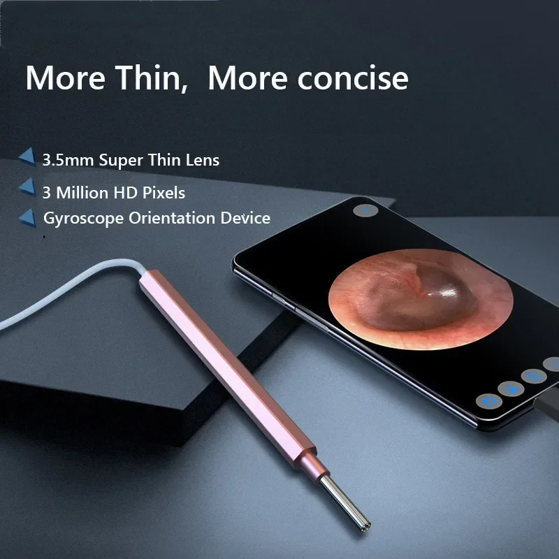 

4.3mm Lens Digital Medico Otoscope In Ear Cleaning Endoscope Camera Ear Wax Removal Visual Ear Mouth Nose Inspection Android PC