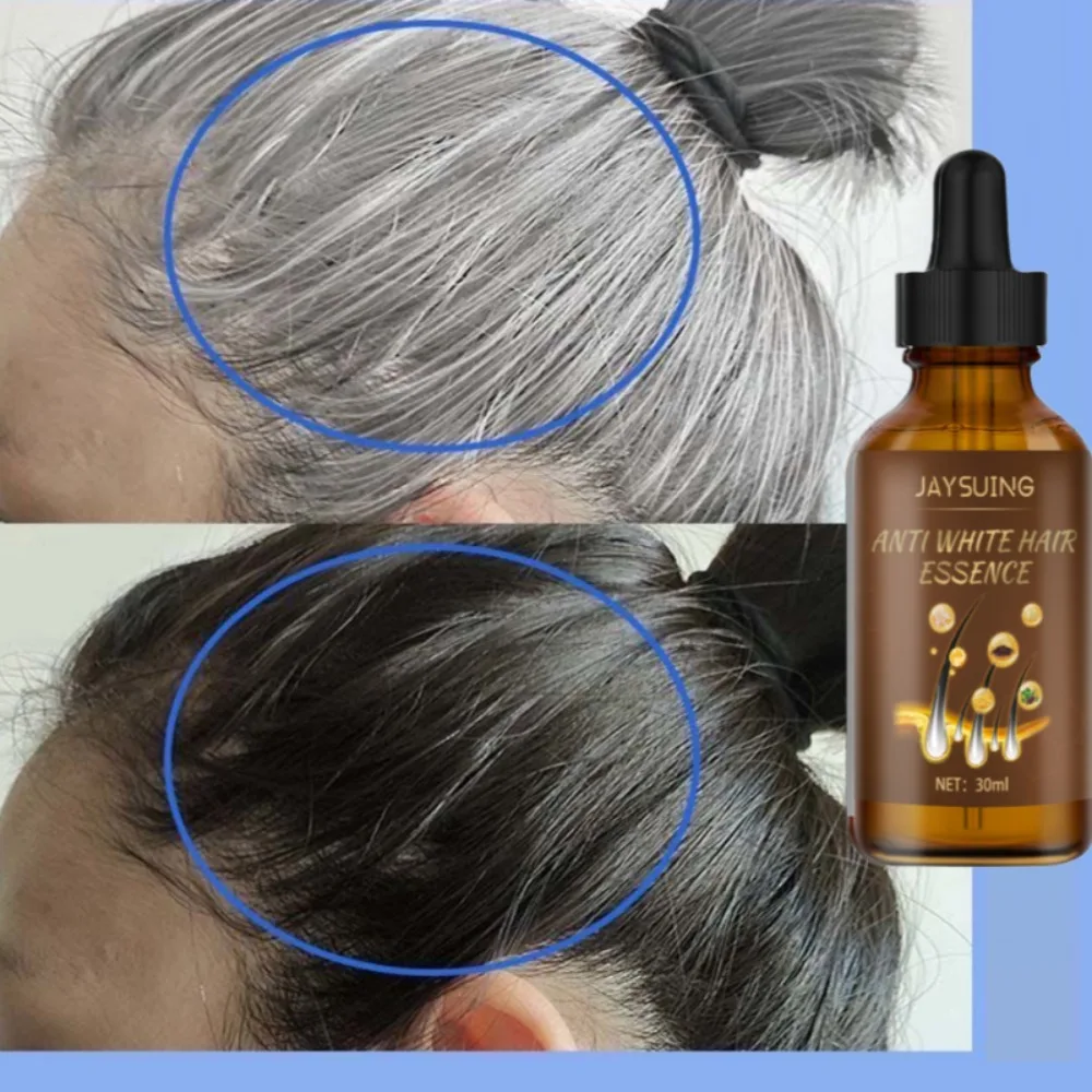 Lasting Anti Gray Hair Treatment Serum White to Black Hair Growth Natural Color Repair Nourish Men Women Anti Hair Loss Products