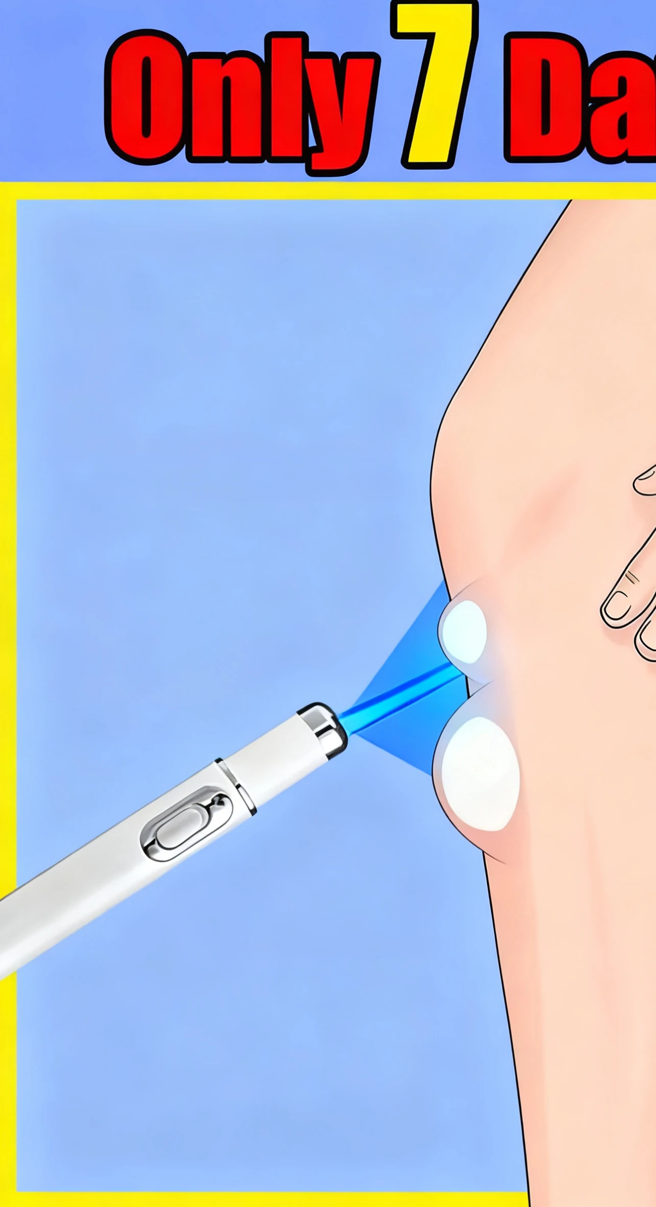 

Профессиональная ручка для ухода за кожей с синим лазером, для снижения внешнего вида пятен и способствующего сияющего сияния.