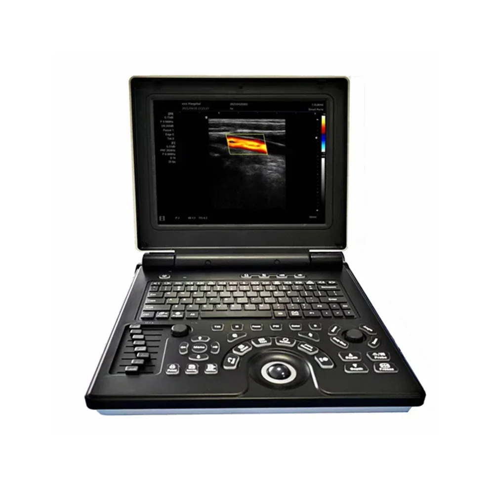 12 Inch Advanced 3D Color Doppler Medical Portable Laptop Notebook pregnanc Ultrasound Scanner Machine