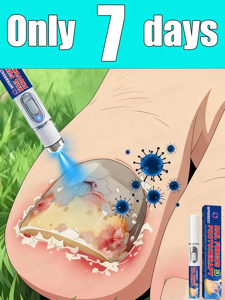 

Горячая новинка 2026 года: Новейший инновационный аппарат для маникюра (для ногтей) без повторов.