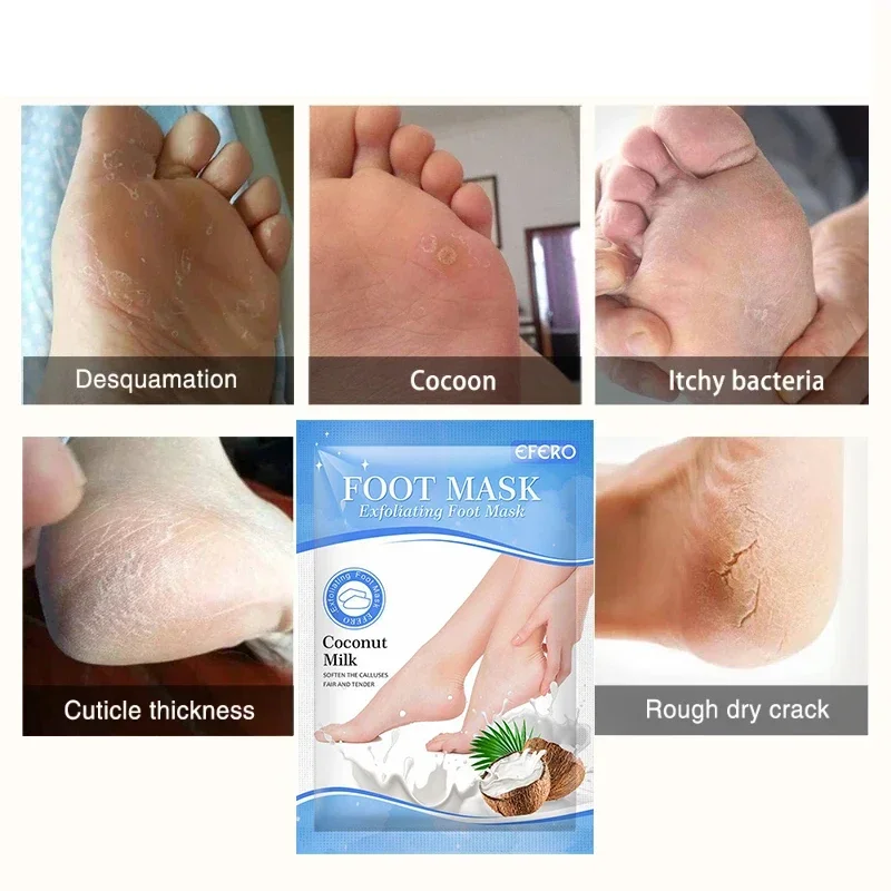 Exfoliating Foot Mask Anti Drying Cracking Heel Peeling Dead Skin Remover Feet Moisturizing Spa Pedicure Coconut Milk Care Socks