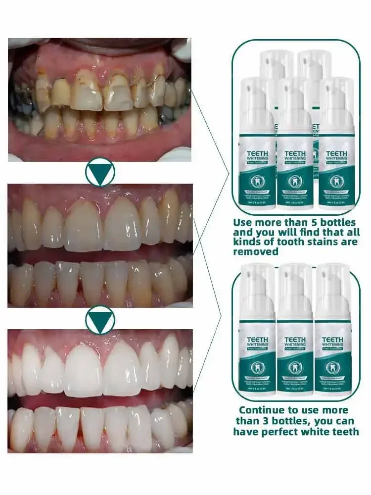 Protect teeth, remove plaque, clean toothpaste, dental health, beauty care