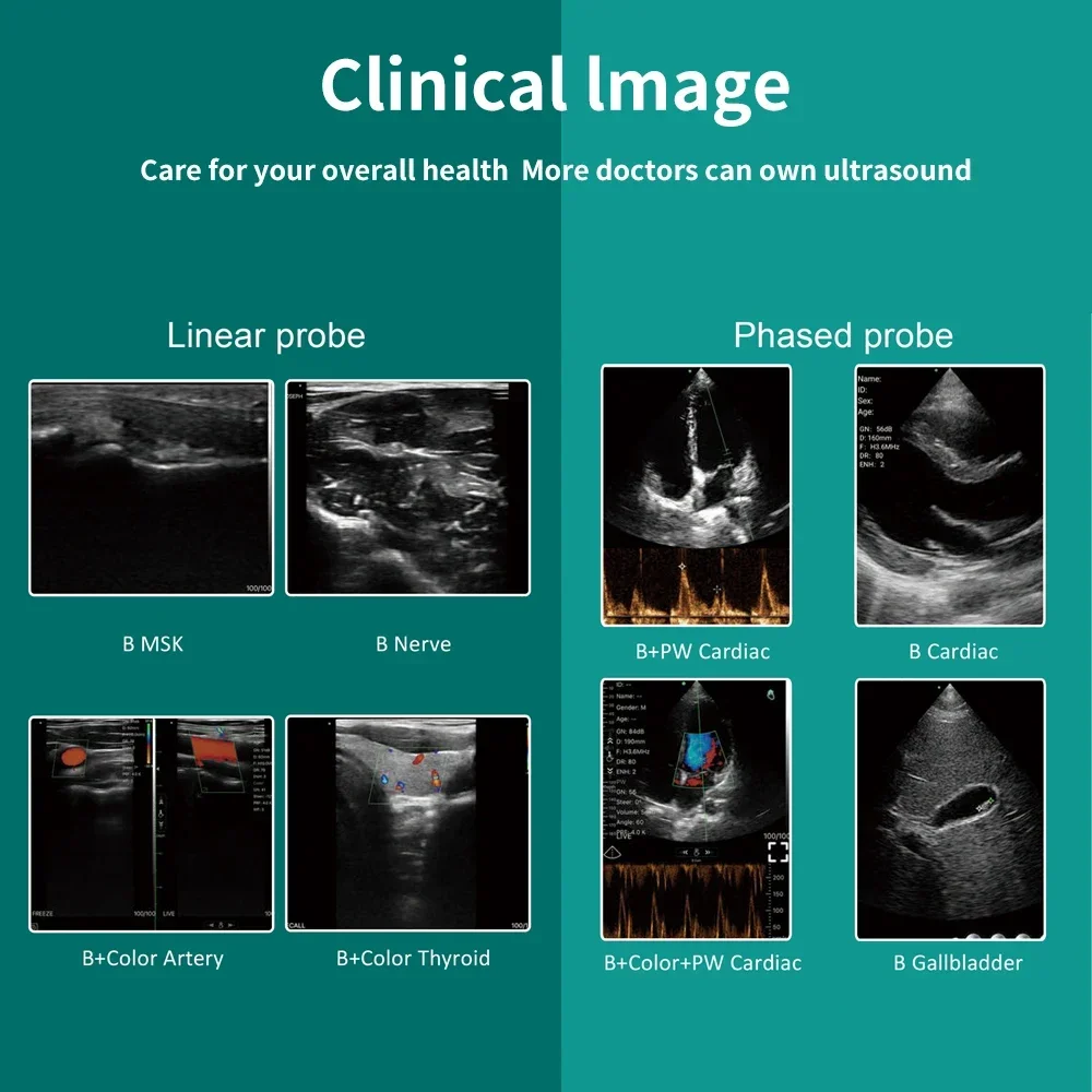 Dual 128 Wifi Ultrasound Multipurpose Linear+cardiac Ultrasound Probe for Blood Vessels, Nerves, Musculoskeletal