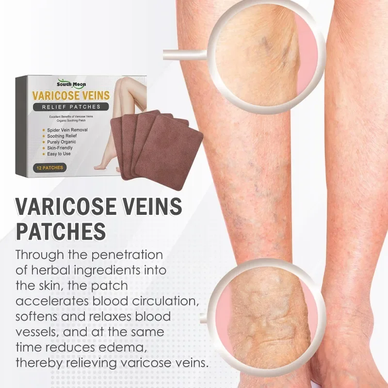 Parche para venas varicosas, parches para aliviar la vasculitis de las piernas, flebitis, tratamiento del dolor de araña, pegatinas para el cuidado