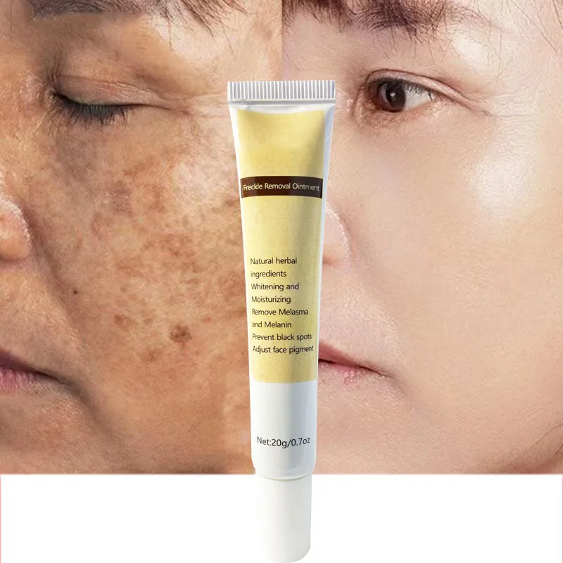 

Facial Moisturizing Repair Cream Freckles Fade Dark Spots Reduce Melanin Whitening Brightens Skin Moisturizes Skin Care