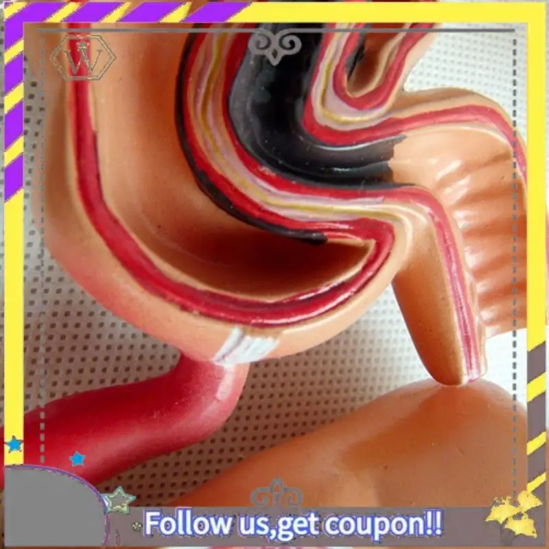 New Teaching Model,Human Large Intestine Anatomy Model Visceral Lesion Model Human Digestive System Learning Model Easy Install
