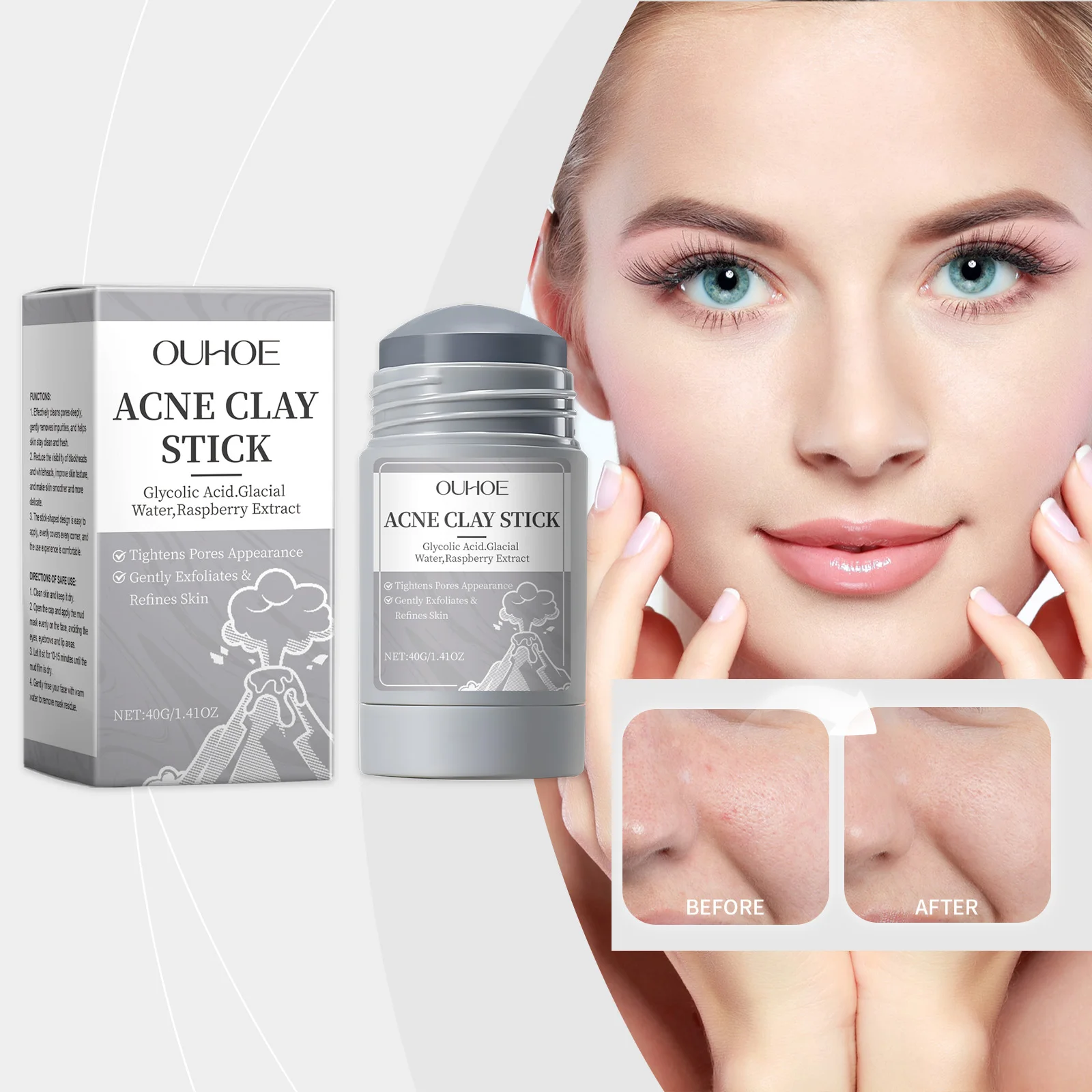 ACNE CLAY STICK - Glycolic Acid & Raspberry Extract Face Exfoliator for Pore Tightening, Blackhead Removal, Oil Control