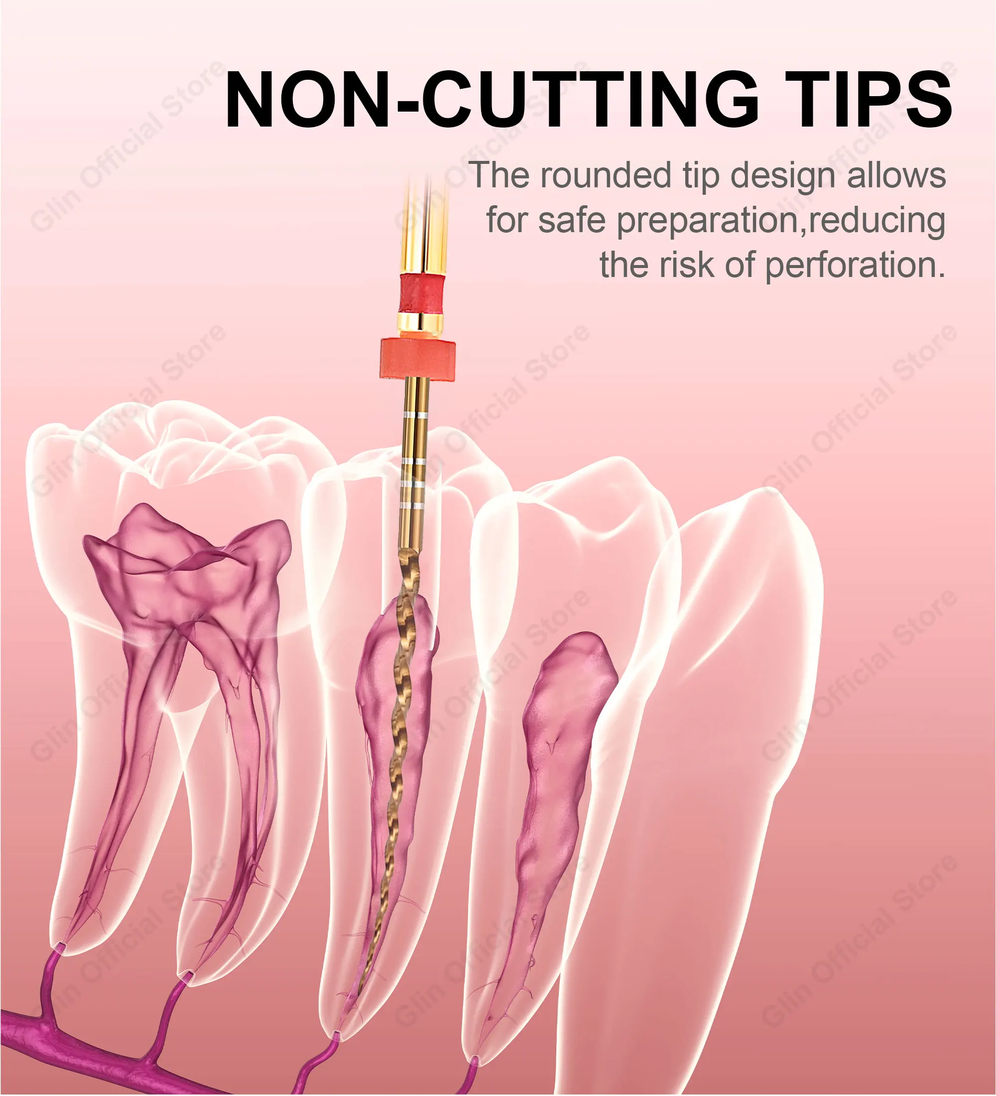 Glin Dental Endodontische Feilen 19/21/25/31mm F3 F4 F5 Gold Flexible Feilen Wärmeaktivierbare Endo-Wurzelkanal-Rotationsfeilen Goldene Feilen – Detail 5