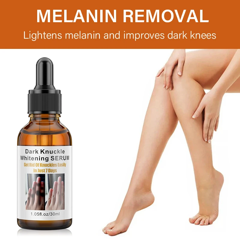 1Pc Dark Knuckles Whitening Serum Remover Get Rid Of Dark Knees Dark Knuckle Elbow Cream Moisturizing Brighten Skin Tone Care.