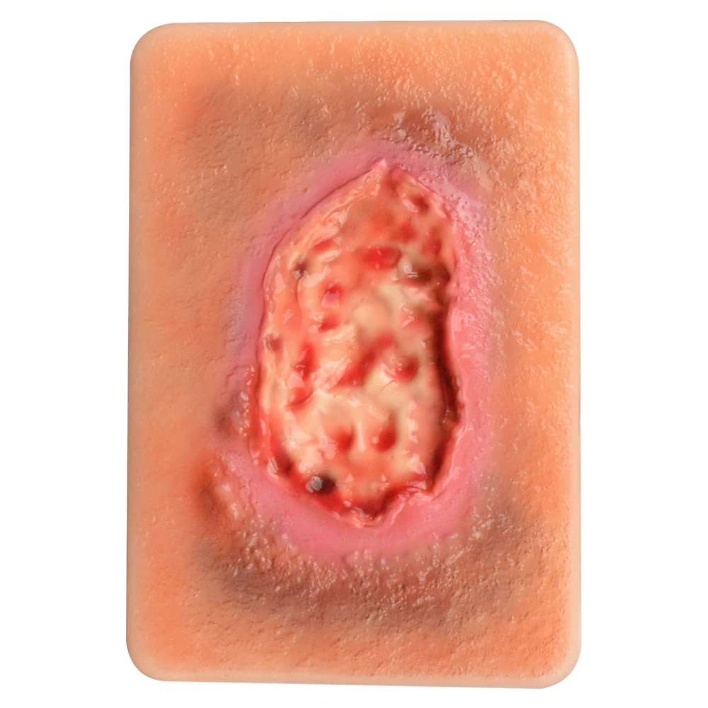 3 Types Of Necrotic Tissue Model Pocket Wound Card For Wound Care Education In TCCC/EMT/PHEC Courses Medical Science Product