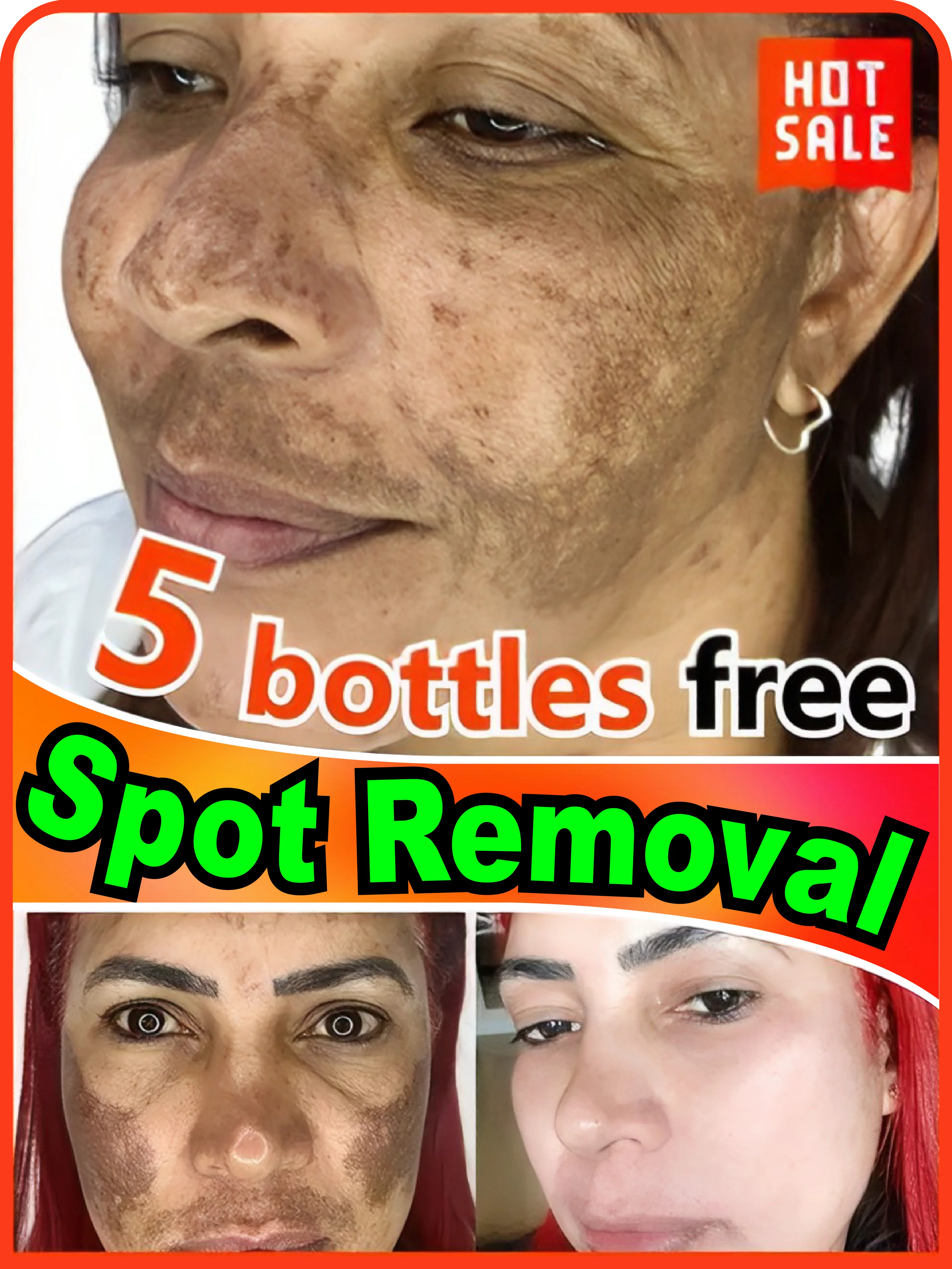 Effectively solves all pigmentation symptoms