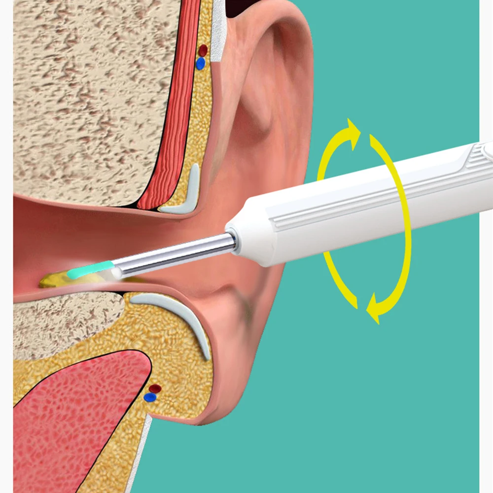 Smart Visual Ear Cleaner, cuidados de saúde, remoção de cera, IP67 impermeável, otoscópio, Wi-Fi, endoscópio, HD1080P, 3,5mm