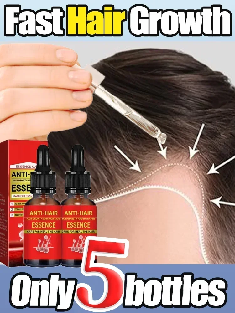 

Rapid hair growth essential oil, repair baldness