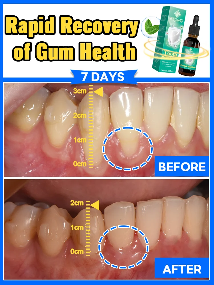 

Repair damaged gums, relieve gum pain, strengthen gums, and restore healthy gums