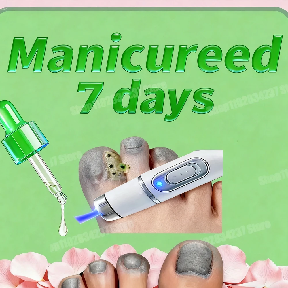 Rejuvenescedor - Tecnologia de prevenção de fungos - Controle ajustável e sensor de segurança222 Caneta laser 295