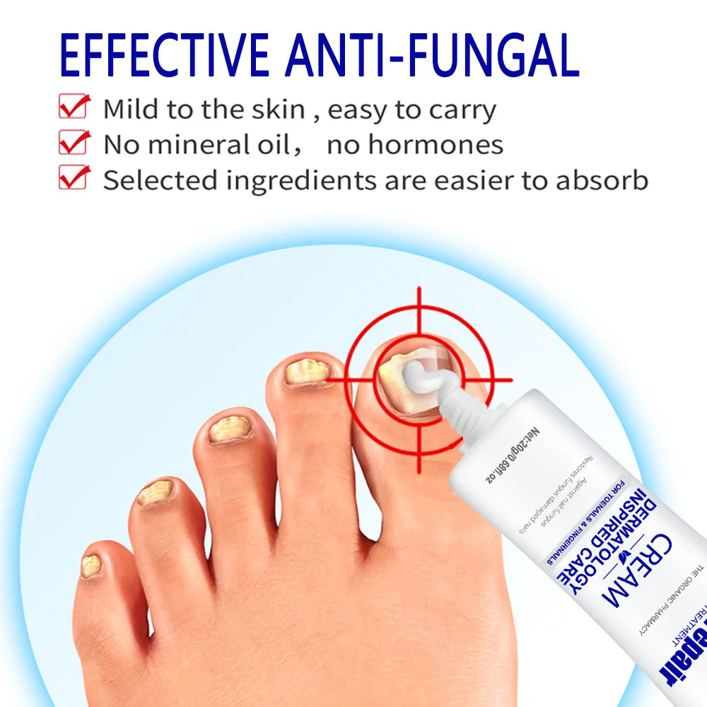 Extra Strong Nail Repair Cream Anti Infection Nail Fungus Treatments Feet Onychomycosis Repair Product Unisex Feet Care 20g