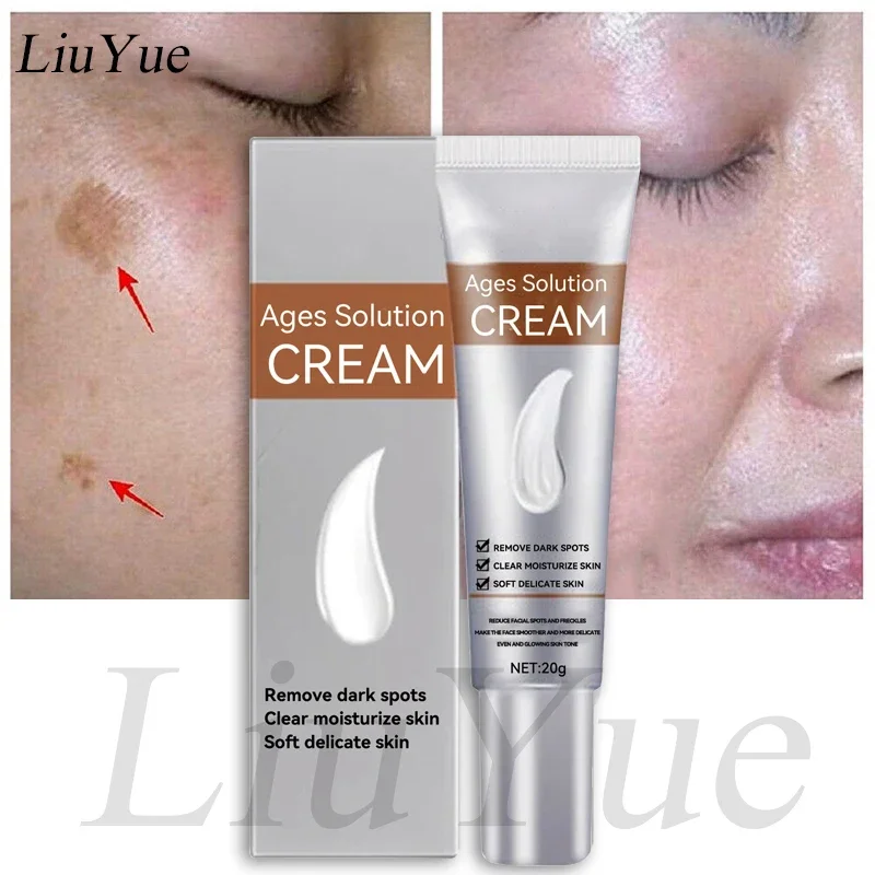 Remove Dark Spots Anti-aging Cream Whiten Improve Fine Lines Anti-wrinkle Cream Niacinamide Brighten Serum Retinol Freckle Cream