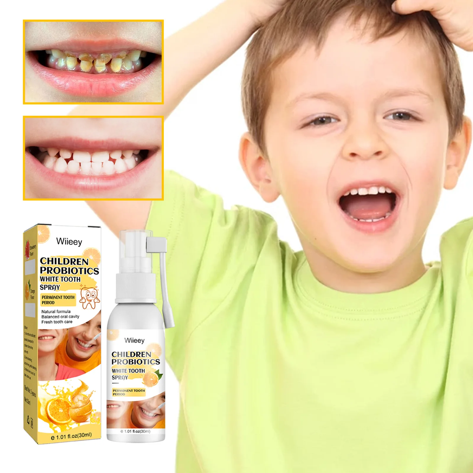 Espray blanqueador de dientes para niños, fórmula Natural segura, limpieza de la boca, dientes saludables, aliento fresco, espray para el cuidado Dental