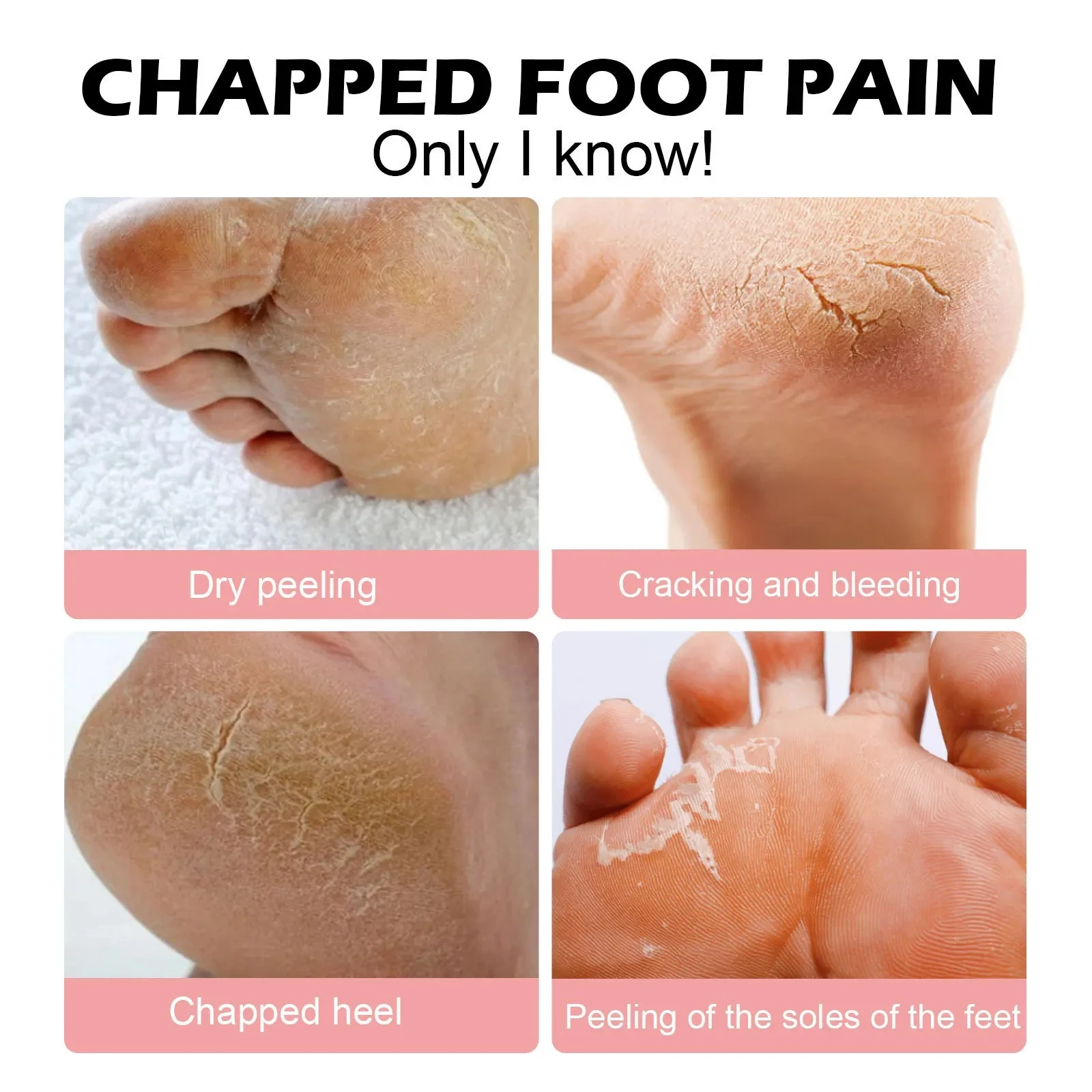 Anti Cracked Foot Cream Remove Dead Skin Calluse Soften Repair Drying Chapping Peeling Heel Feet Exfoliating Moisturizing Cream