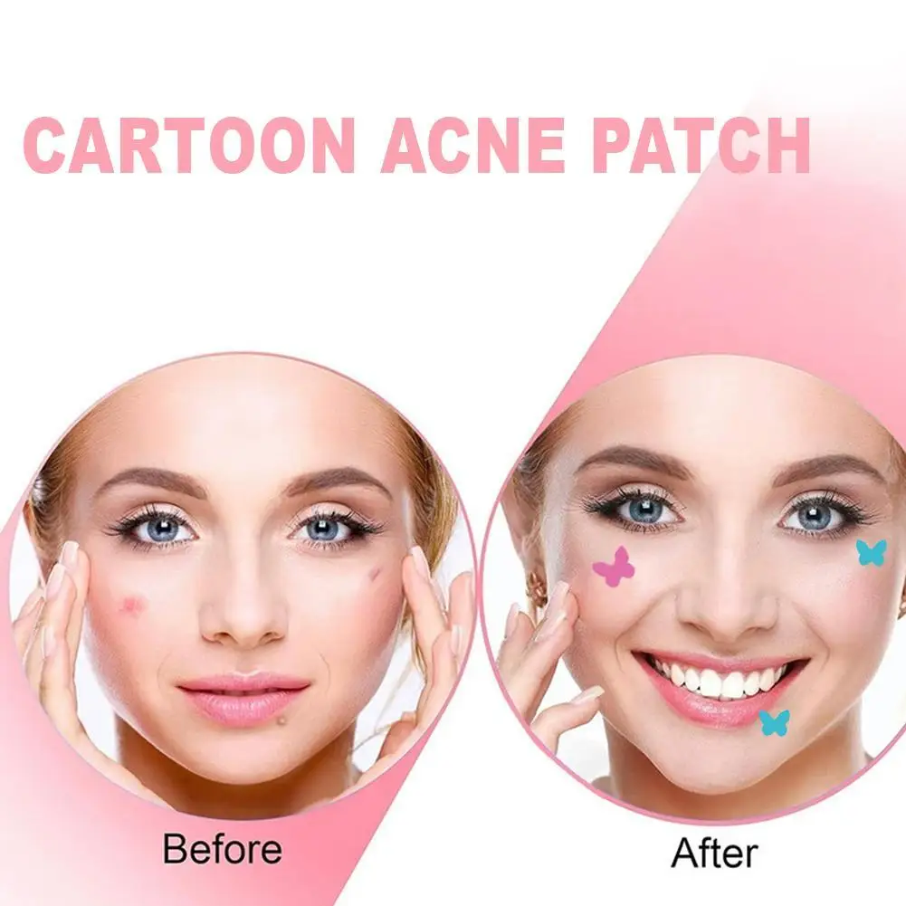 

New Star Cartoon Shaped Color Acne Patch Suction Pus Portable Acne Patch Independent Packaging Patches Of Stars