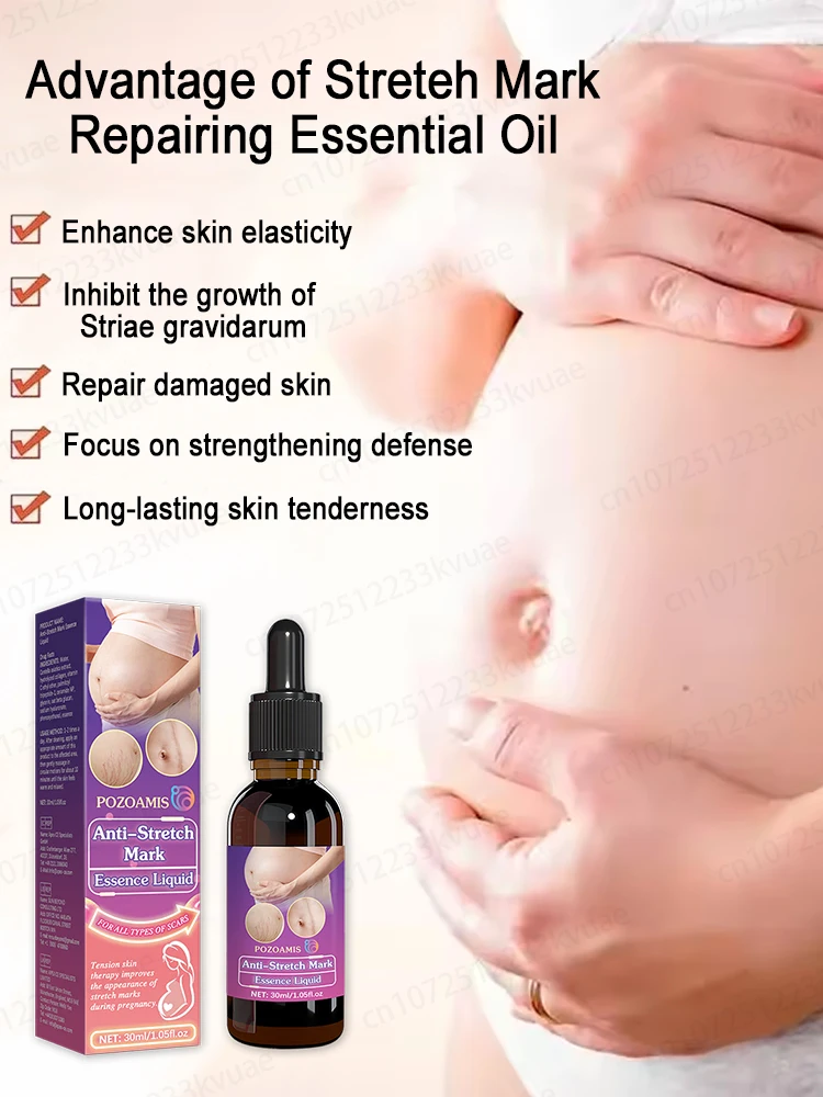 Entfernen Sie Dehnungsstreifen, berechnen Sie Streifen vor, beseitigen Sie sich, beseitigen Sie keine Narben in nur 7 Tagen