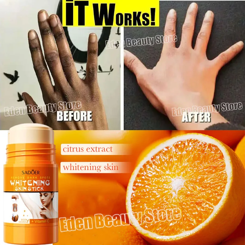 

Dark Knuckles Brighten Stick Cream Fast Whitening Elbows Knee Intense Stains Removal Melanin Corrector Body Skin Care Products