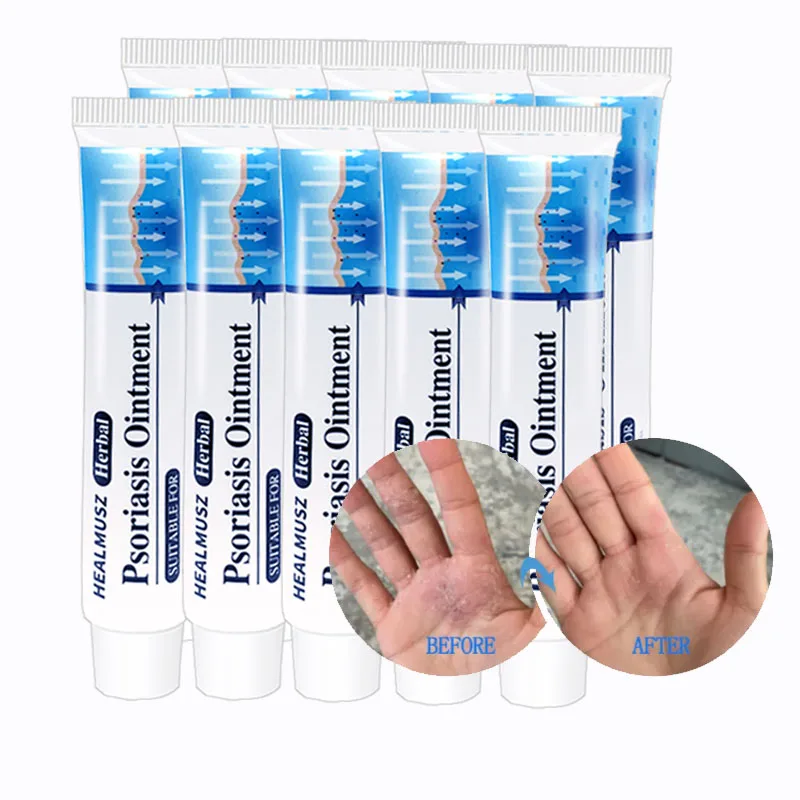 

5-10pcs Psoriasis Ointment from Eczema Antibacterial Chinese Herbal Effective Anti-itch Relief Dermatitis Urticaria Unguent