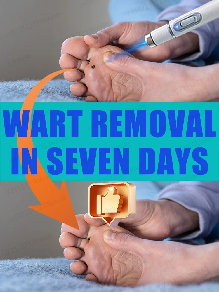 Hot selling wart removal tool, click to order now and change your life
