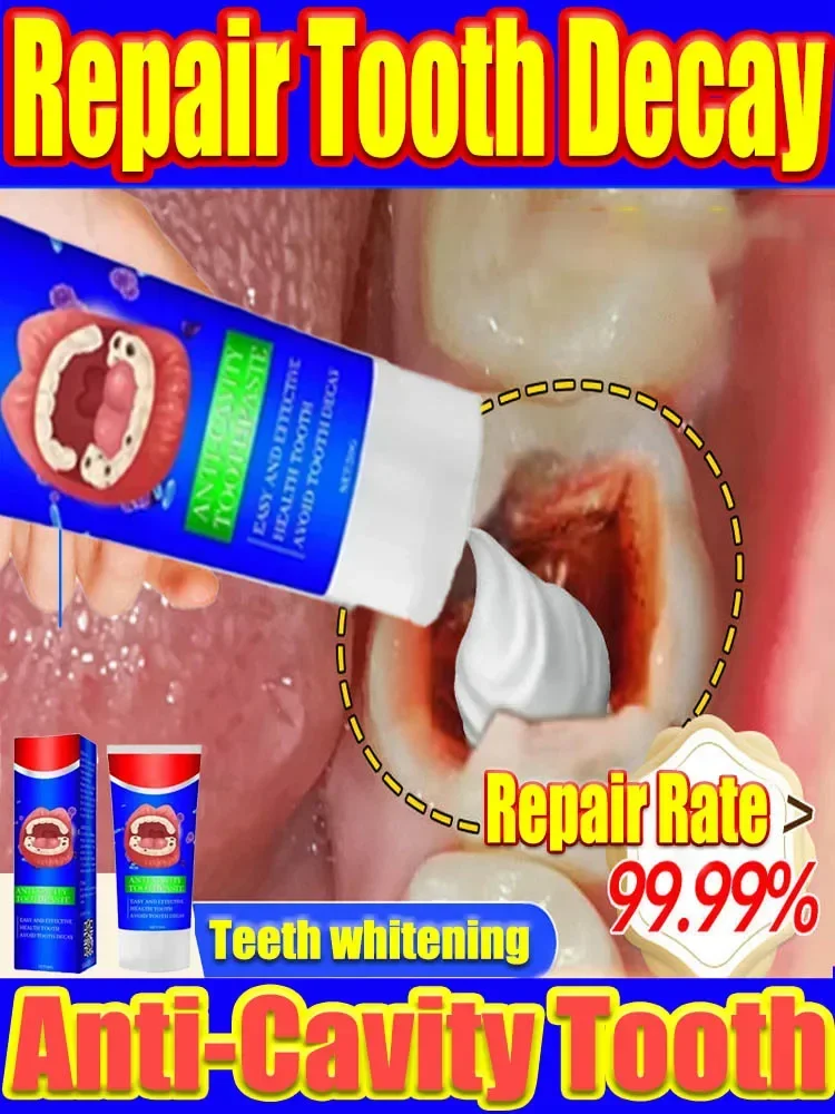 Professional Teeth Whitening Anti-cavity Decay Fresh Bad Breath Repair Tooth Decay Remove Plaque Toothache Relieve Periodontitis