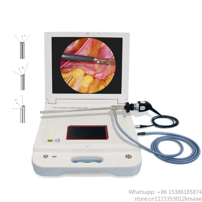 17 Inch HD All-in-One Portable Endoscope Camera System for ENT and Digital Otoscopy