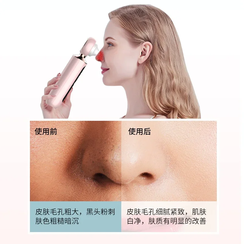 New electric blackhead removal, pore cleaning, acne removal, oil removal, facial home beauty instrument, blackhead visualization