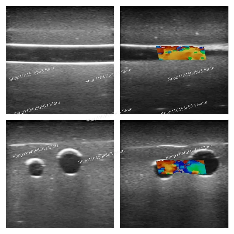 PICC catheterization training module simulates blood circulation color Doppler