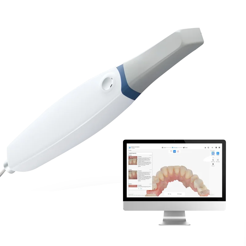 

Runyes IOS-11 Digital Dental Intraoral Scanner Portable Handheld Support Printing Reports 3d X-Ray AI Scanner for dental lab