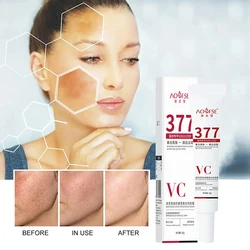 Niacinamide Melasma Brightening Cream Reduce Melanin Brighten Lighten Dark Skin Chloasma Repair Serum Face Care Products