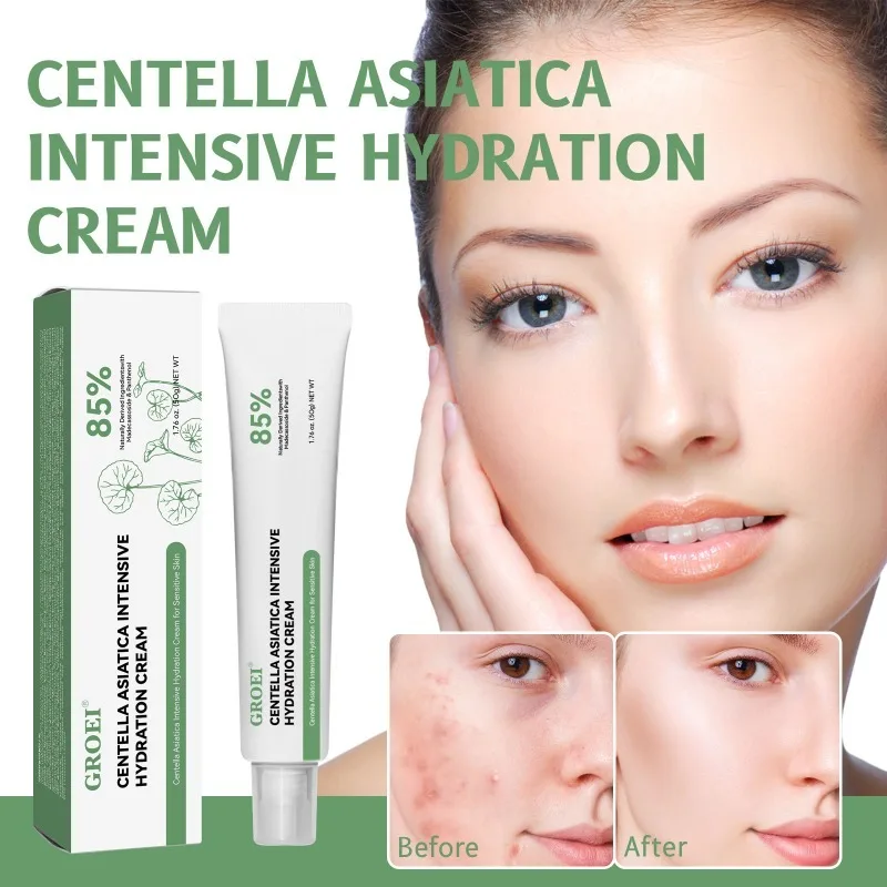 

Альфа-арбутин Крем для лица Уменьшает меланин Выравнивает тон кожи Осветляет цвет лица Антитусклый отбеливающий крем