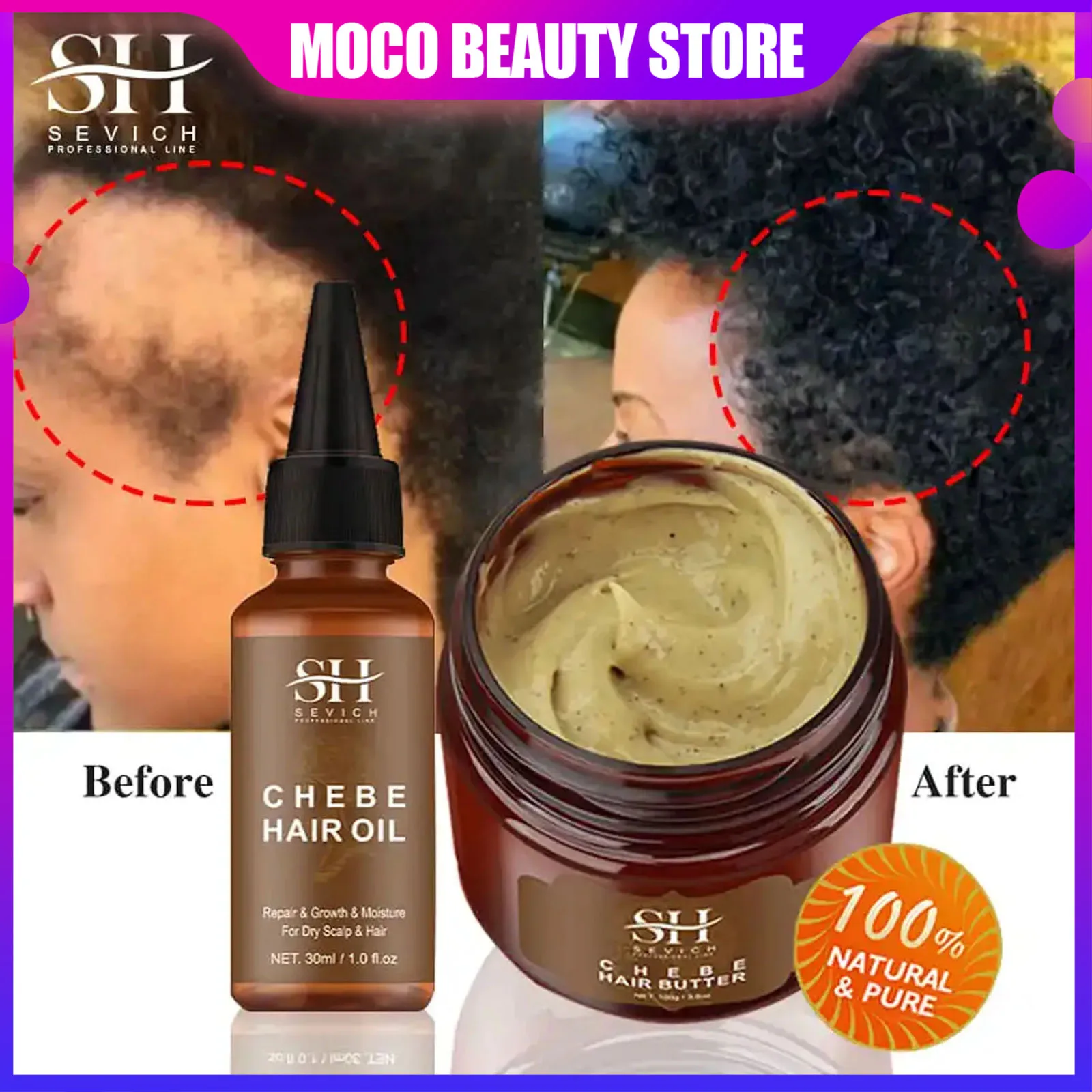 Chebe Fast Hair Growth Product African Crazy Traction Alopecia Hair Oil Anti Hair Break Hair Strengthen Hair Loss Treatment Care