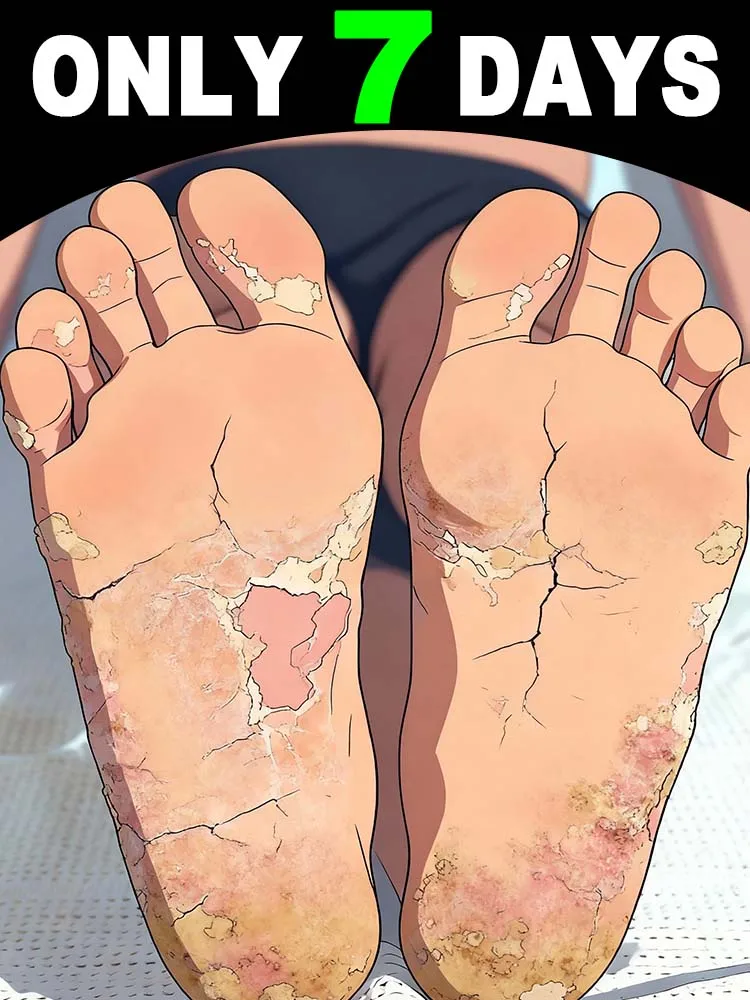 Hᴇᴀʟɪɴɢ Fᴏᴏᴛ Uʟᴄᴇʀs, Tɪɴᴇᴀ Pᴇᴅɪs, Aɴᴅ Fᴜɴɢᴀʟ Iɴғᴇᴄᴛɪᴏɴs Oғ Tʜᴇ Fᴇᴇᴛ Natural care