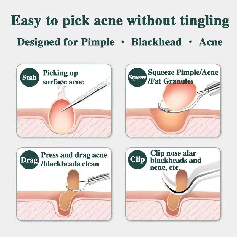 Acne agulha cravo célula clipe terno dupla-cabeça acne agulha acne remoção agulha pinças precisão acne clipe acne ferramenta