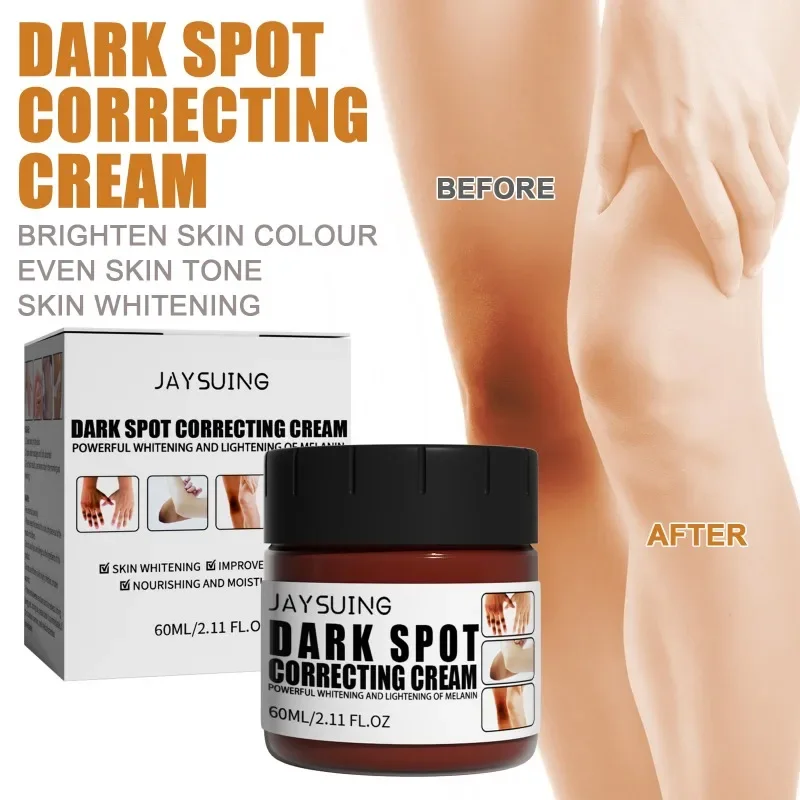 Join remove Dark Spot clean Cream, blanqueamiento de axilas, rodilla, muslos internos, cuerpo, aclara la melanina, axila, ilumina el cuidado de la