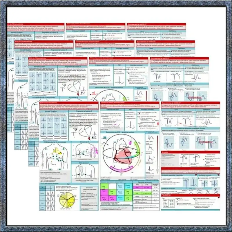 Aug. Ecg Interpreta…