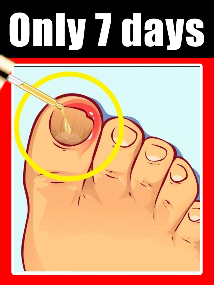 

Второе поколение средств для ухода за огрубевшими и тусклыми ногтями, сохраняющее мягкость и блеск кончиков пальцев.