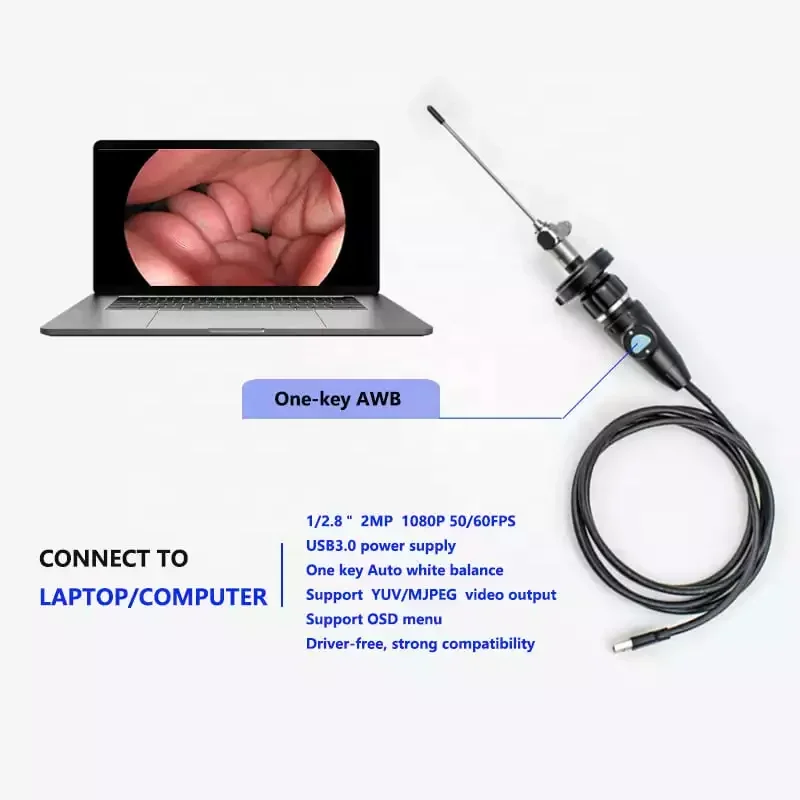 

Factory Price USB 3.0 Full HD Portable Medical Endoscope Camera for Otoscope Laparoscopic Gynecology