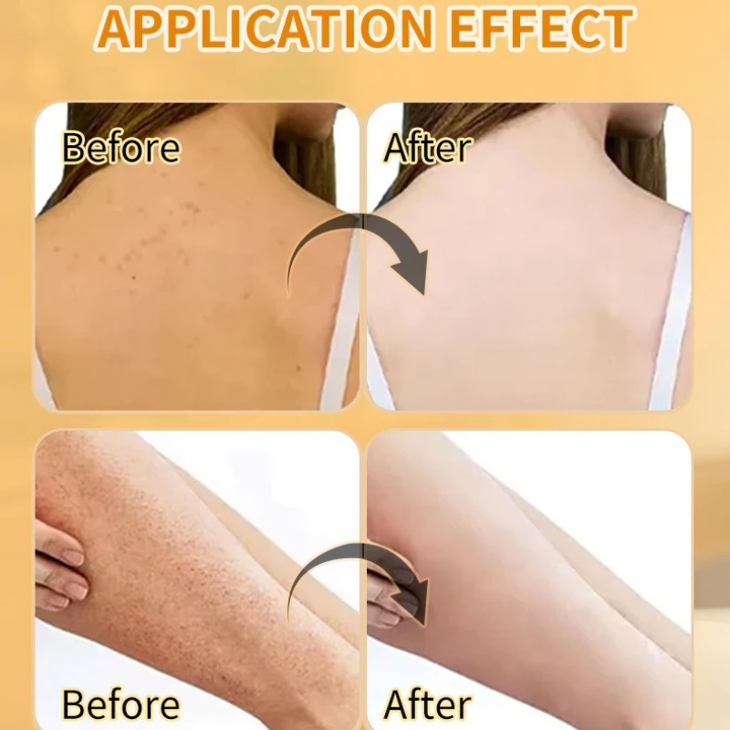 VC & الكركم التقشير سنفرة الجسم تبييض اشراق إزالة الجلد الميت تغذي السلس منظف الجسم العناية بالبشرة